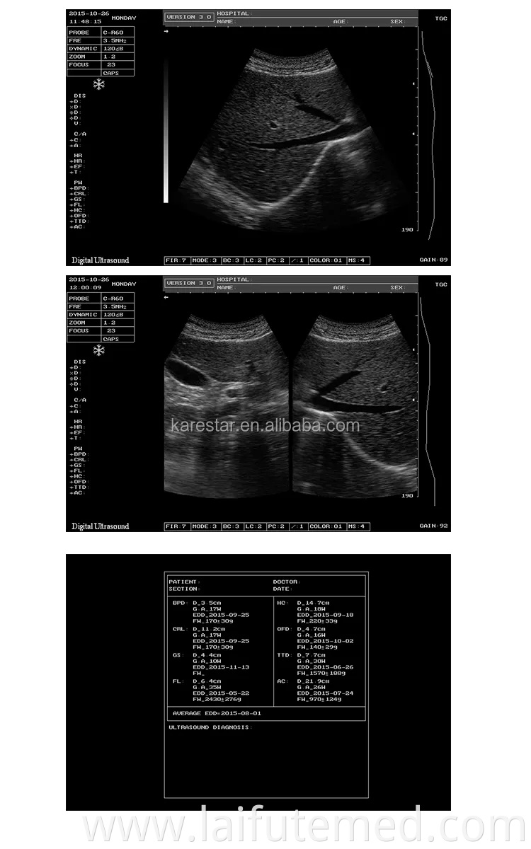 Veterinary Digital Ultrasonic Diagnostic Imaging System Portable Laptop B/W Handheld Ultrasound